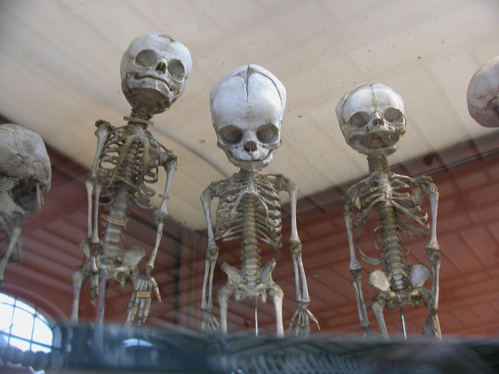 fetal skeletons